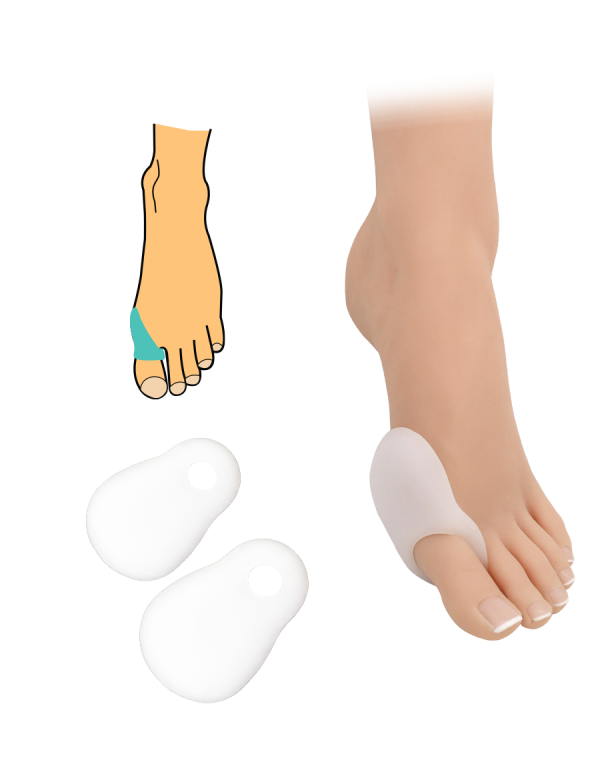 Hallux valgus hüvelykujj ízületvédő - 2 db